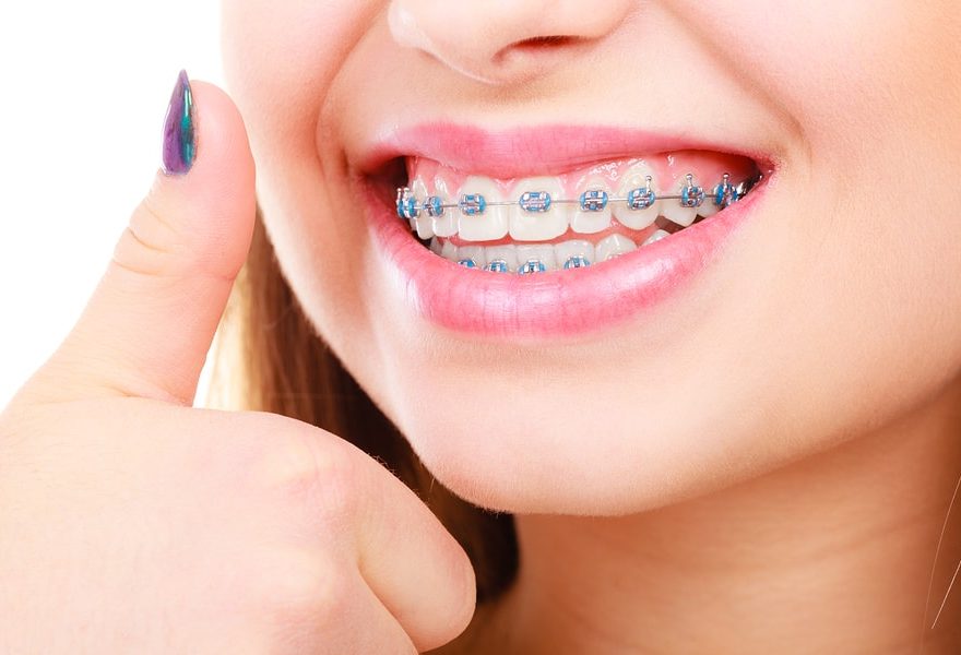 Orthodontic Treatments, Orthodontics