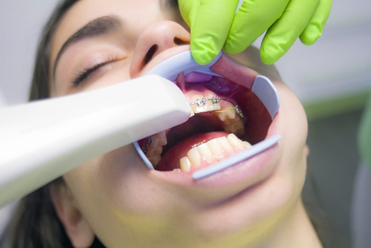 Orthodontics Treatment Grande Prairie